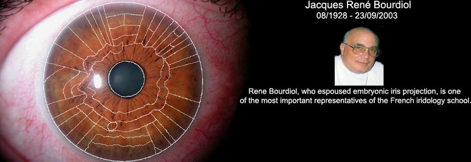 An iris with a zone chart drawn over it, beside a portrait of Jacques René Bourdiol.
