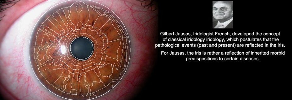 An iris with a zone chart drawn over it, beside a portrait of Gilbert Jausas.