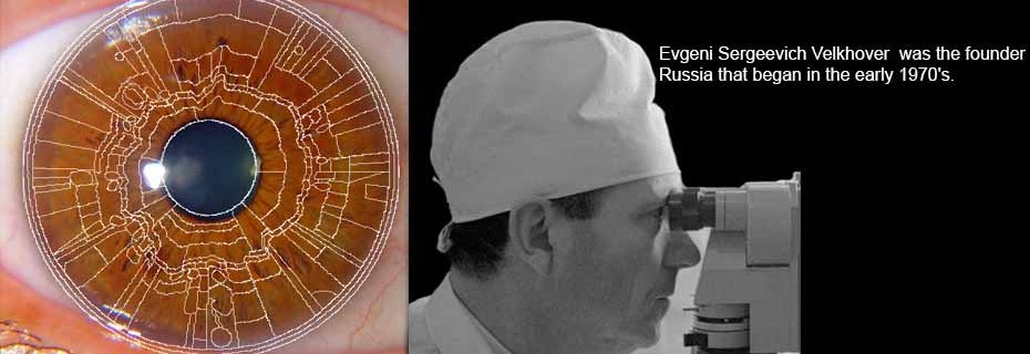 An iris with a zone chart drawn over it, beside a photograph of Evgeni Velkhover at an iris microscope.